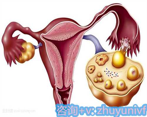 小排畸和大排畸的区别是什么