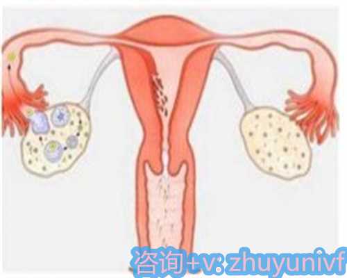 安徽助孕正规公司排行榜,让试管婴儿成为一种更普遍的生育方式