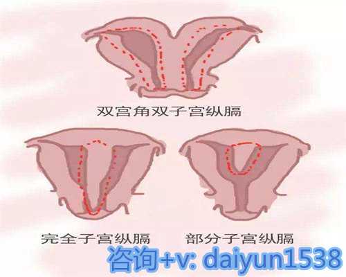 上海正规供卵代怀公司技术,让不孕不育夫妇的生命之花再次绽放