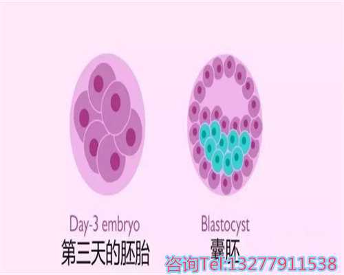 西安正规医院有偿供卵费用,科技加持，帮您实现生育梦想