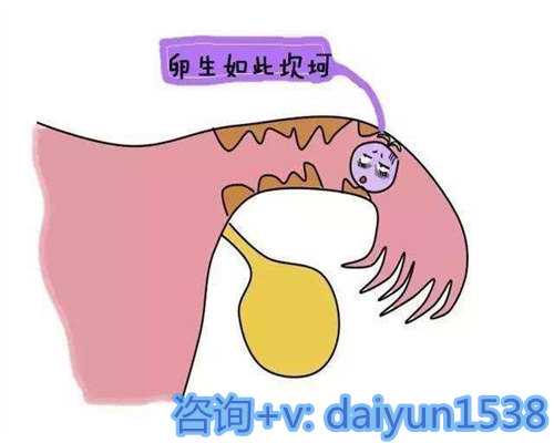 西安供卵正规医院,为您提供个性化的不孕不育治疗服务