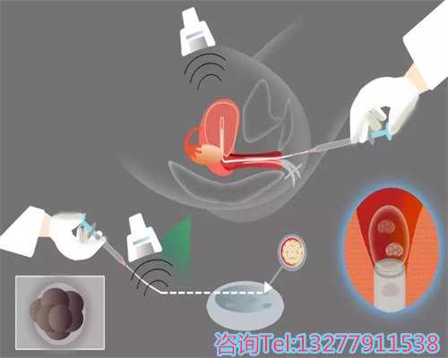 长春有几家做供卵试管,选择最安全的生育方式，吉林找人代怀